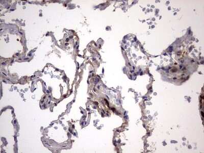 Immunohistochemistry: Galectin-3 Antibody (OTI1C7) [NBP2-45618]