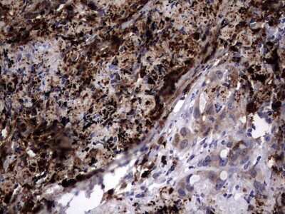 Immunohistochemistry: Galectin-3 Antibody (OTI1C7) [NBP2-45618]