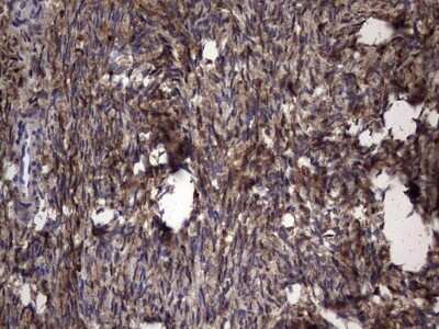 Immunohistochemistry: Galectin-3 Antibody (OTI1C7) [NBP2-45618]