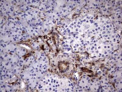 Immunohistochemistry: Galectin-3 Antibody (OTI1C7) [NBP2-45618]