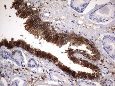 Immunohistochemistry: Galectin-3 Antibody (OTI1C7) [NBP2-45618]