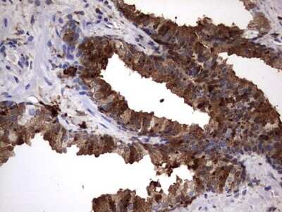 Immunohistochemistry: Galectin-3 Antibody (OTI1C7) [NBP2-45618]