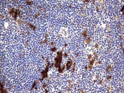 Immunohistochemistry: Galectin-3 Antibody (OTI1C7) [NBP2-45618]
