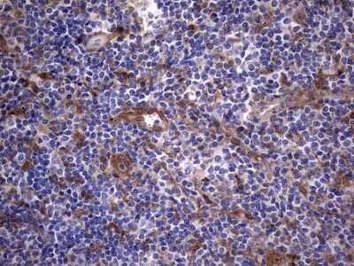 Immunohistochemistry: Galectin-3 Antibody (OTI1C7) [NBP2-45618]