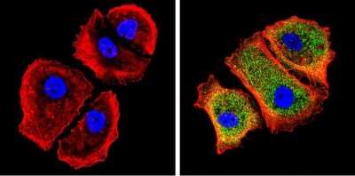 Immunocytochemistry/ Immunofluorescence: Galectin-3 Antibody (A3A12) - BSA Free [NB300-538]