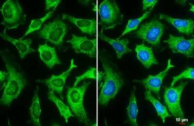 Immunocytochemistry/ Immunofluorescence: Galectin-3 Antibody (GT12712) [NBP3-13641]