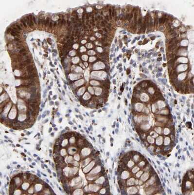 Immunohistochemistry-Paraffin: Galectin-3 Antibody [NBP1-89795]