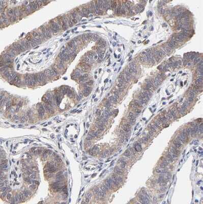 Immunohistochemistry-Paraffin: Galectin-3 Antibody [NBP1-89795]