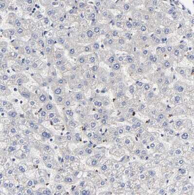 Immunohistochemistry-Paraffin: Galectin-3 Antibody [NBP1-89795]