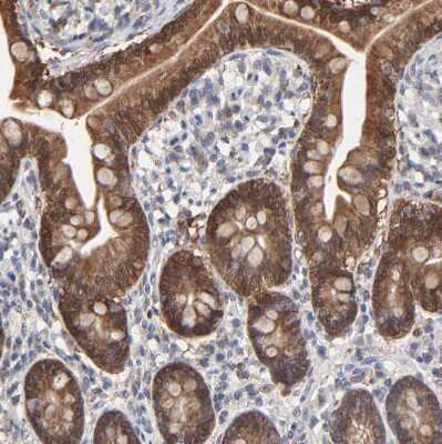 Immunohistochemistry-Paraffin: Galectin-3 Antibody [NBP1-89795]