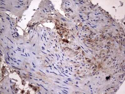 Immunohistochemistry: Galectin-3 Antibody (OTI1C7) - Azide and BSA Free [NBP2-71124]
