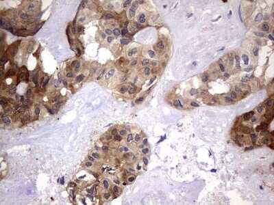 Immunohistochemistry: Galectin-3 Antibody (OTI1C7) - Azide and BSA Free [NBP2-71124]