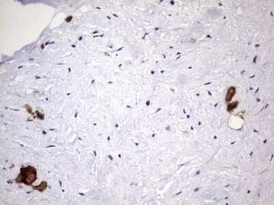 Immunohistochemistry: Galectin-3 Antibody (OTI1C7) - Azide and BSA Free [NBP2-71124]