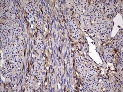 Immunohistochemistry: Galectin-3 Antibody (OTI1C7) - Azide and BSA Free [NBP2-71124]