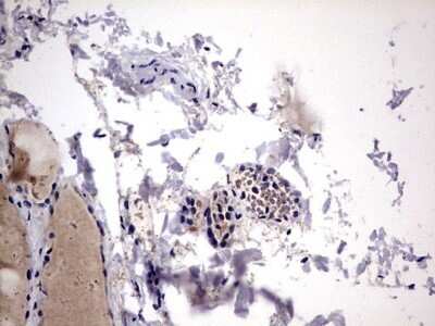 Immunohistochemistry: Galectin-3 Antibody (OTI1C7) - Azide and BSA Free [NBP2-71124]