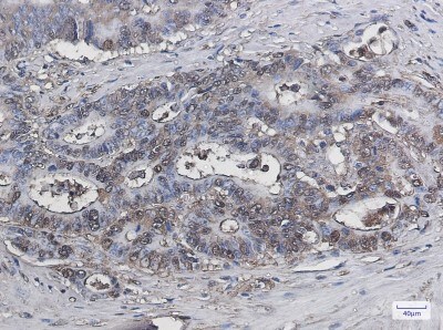 Immunohistochemistry-Paraffin: Galectin-3 Antibody (S05-8J4) [NBP3-20038]