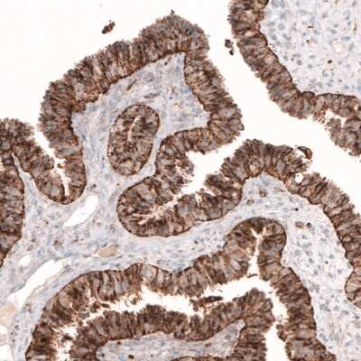 Immunohistochemistry-Paraffin: Galectin-3BP/MAC-2BP/LGALS3BP Antibody [NBP1-89346]