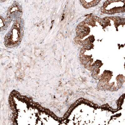 Immunohistochemistry-Paraffin: Galectin-3BP/MAC-2BP/LGALS3BP Antibody [NBP1-89346]