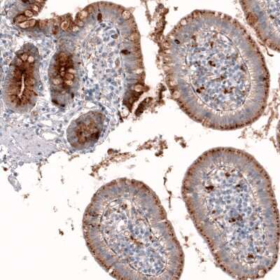 Immunohistochemistry-Paraffin: Galectin-3BP/MAC-2BP/LGALS3BP Antibody [NBP1-89346]