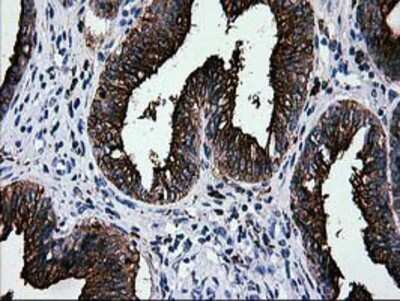 Immunohistochemistry: Galectin-3BP/MAC-2BP/LGALS3BP Antibody (OTI6B7) - Azide and BSA Free [NBP2-71125]