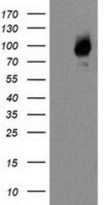 Western Blot: Galectin-3BP/MAC-2BP/LGALS3BP Antibody (OTI6B7)Azide and BSA Free [NBP2-71125]
