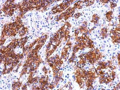 Immunohistochemistry-Paraffin: Galectin-4 Antibody [NBP2-16583]