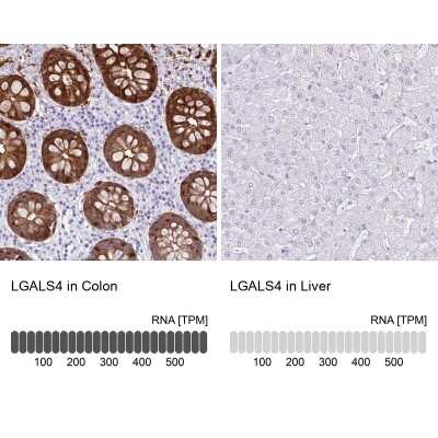 Immunohistochemistry-Paraffin: Galectin-4 Antibody [NBP2-48606]