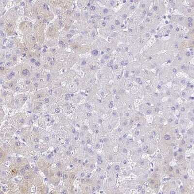 Immunohistochemistry-Paraffin: Galectin-4 Antibody [NBP2-48607]