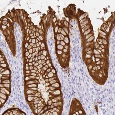 Immunohistochemistry-Paraffin: Galectin-4 Antibody [NBP2-48607]