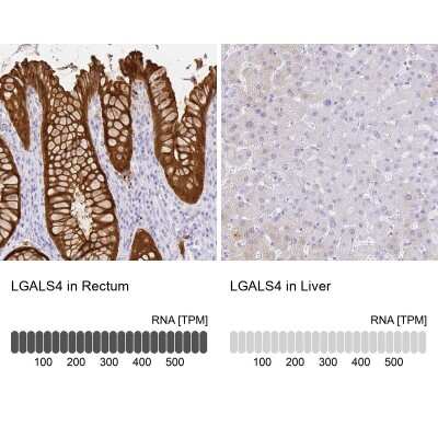 Immunohistochemistry-Paraffin: Galectin-4 Antibody [NBP2-48607]
