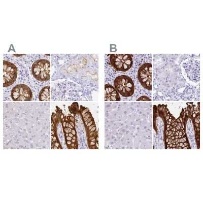 Immunohistochemistry-Paraffin: Galectin-4 Antibody [NBP2-48607]