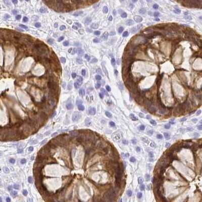 Immunohistochemistry-Paraffin: Galectin-4 Antibody [NBP2-48607]