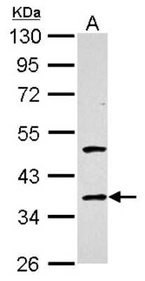 Western Blot: Galectin-4 Antibody [NBP2-21573]