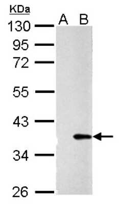 Western Blot: Galectin-4 Antibody [NBP2-21573]