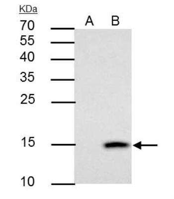 Immunoprecipitation: Galectin-7 Antibody [NBP2-16584]
