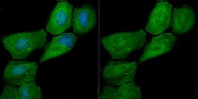 Immunocytochemistry/ Immunofluorescence: Galectin-7 Antibody (JB38-11) [NBP2-75500]