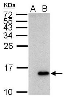 Western Blot: Galectin-7 Antibody [NBP2-16584]