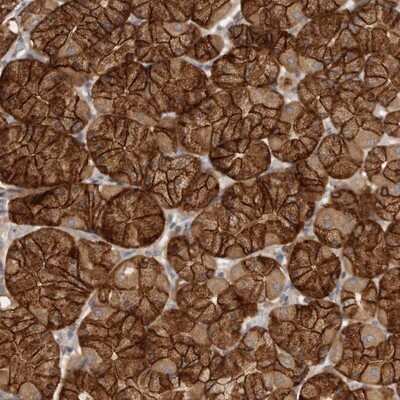 Immunohistochemistry-Paraffin: Galectin-8 Antibody [NBP1-87317]