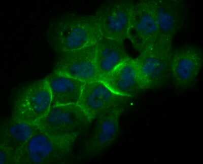Immunocytochemistry/ Immunofluorescence: Galectin-8 Antibody (JB85-35) [NBP2-75501]