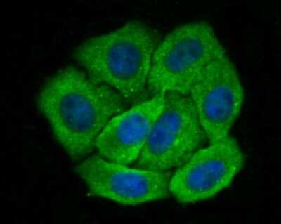 Immunocytochemistry/ Immunofluorescence: Galectin-8 Antibody (JB85-35) [NBP2-75501]