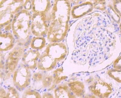 Immunohistochemistry-Paraffin: Galectin-8 Antibody (JB85-35) [NBP2-75501]