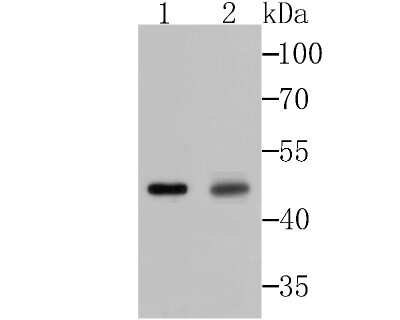Western Blot: Galectin-8 Antibody (JB85-35) [NBP2-75501]