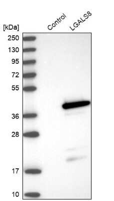 Western Blot: Galectin-8 Antibody [NBP1-87317]