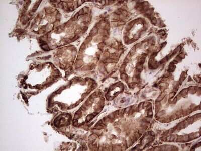 Immunohistochemistry: Galectin-9 Antibody (OTI1D12) [NBP2-45619]