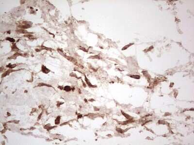Immunohistochemistry: Galectin-9 Antibody (OTI1D12) [NBP2-45619]