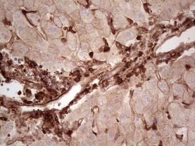Immunohistochemistry: Galectin-9 Antibody (OTI1D12) [NBP2-45619]