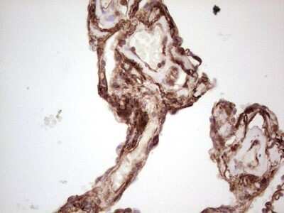 Immunohistochemistry: Galectin-9 Antibody (OTI1D12) [NBP2-45619]