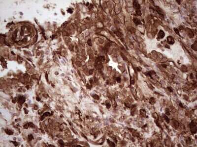 Immunohistochemistry: Galectin-9 Antibody (OTI1D12) [NBP2-45619]