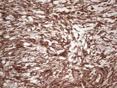 Immunohistochemistry: Galectin-9 Antibody (OTI1D12) [NBP2-45619]