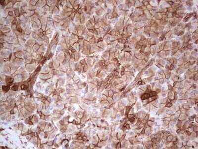 Immunohistochemistry: Galectin-9 Antibody (OTI1D12) [NBP2-45619]